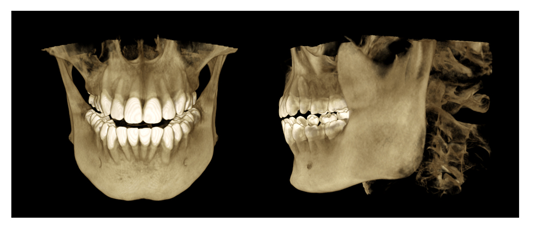 dx-n4.jpg